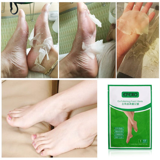 Peeling Exfoliating Foot Peel Treatment